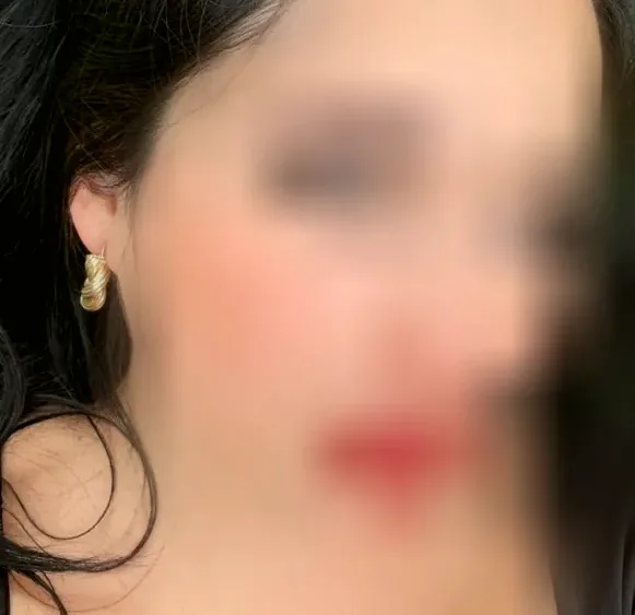 Renate, 37